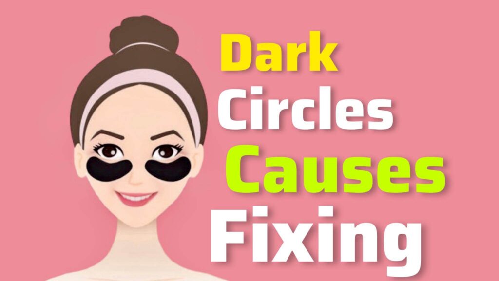 Dark Circles Causes and Fixing the Issue