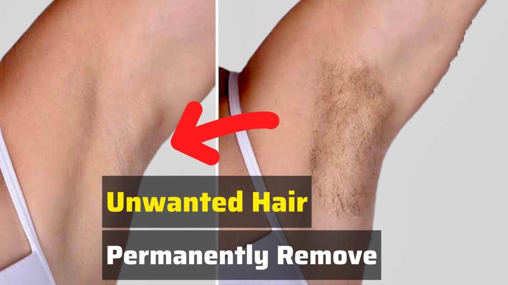How to Remove Unwanted Hair Permanently